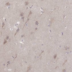 Invitrogen Kir3.3 (KCNJ9) Polyclonal Antibody 100 &mu;L; Unconjugated:Antibodies,