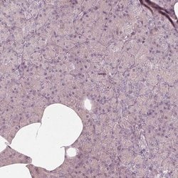 Invitrogen Kir3.3 (KCNJ9) Polyclonal Antibody 100 &mu;L; Unconjugated:Antibodies,
