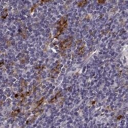 Invitrogen Cyclin F Polyclonal Antibody 100 &mu;L | Buy Online | Invitrogen&trade; | Fisher Scientific