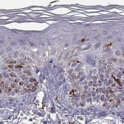 Invitrogen Cyclin F Polyclonal Antibody 100 &mu;L | Buy Online | Invitrogen&trade; | Fisher Scientific