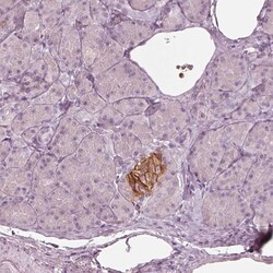 Invitrogen GPRIN1 Polyclonal Antibody 100 &mu;L | Buy Online | Invitrogen&trade; | Fisher Scientific