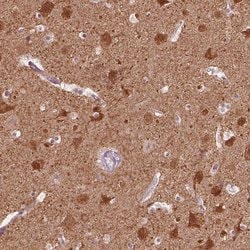 Invitrogen GPRIN1 Polyclonal Antibody 100 &mu;L; Unconjugated:Antibodies,
