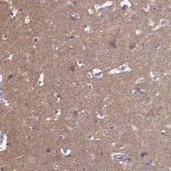 Invitrogen FRRS1L Polyclonal Antibody 100 &mu;L; Unconjugated:Antibodies,