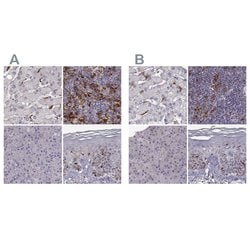 Invitrogen Cyclin F Polyclonal Antibody 100 &mu;L; Unconjugated:Antibodies,