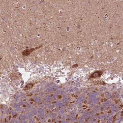 Invitrogen SLC25A5 Polyclonal Antibody 100 &mu;L; Unconjugated:Antibodies,