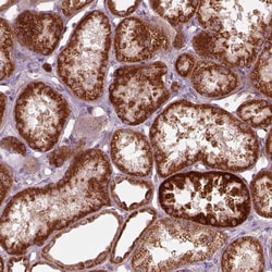 Invitrogen SLC25A5 Polyclonal Antibody 100 &mu;L; Unconjugated:Antibodies,