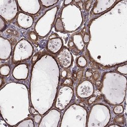 Invitrogen RABGAP1 Polyclonal Antibody 100 &mu;L; Unconjugated:Antibodies,