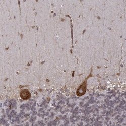 Invitrogen TMEM14A Polyclonal Antibody 100 &mu;L; Unconjugated:Antibodies,