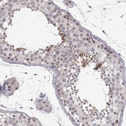 Invitrogen C10orf62 Polyclonal Antibody 100 &mu;L; Unconjugated:Antibodies,