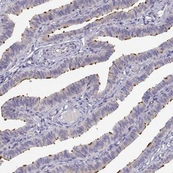 Invitrogen KIF19 Polyclonal Antibody 100 &mu;L | Buy Online | Invitrogen&trade; | Fisher Scientific
