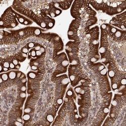 Invitrogen AGPAT1 Polyclonal Antibody 100 &mu;L; Unconjugated:Antibodies,