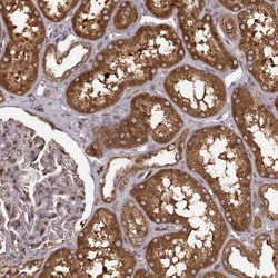 Invitrogen AGPAT1 Polyclonal Antibody 100 &mu;L; Unconjugated:Antibodies,