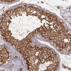 Invitrogen AGPAT1 Polyclonal Antibody 100 &mu;L; Unconjugated:Antibodies,