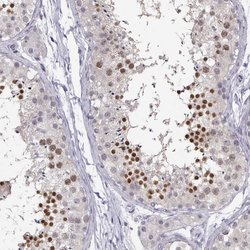 Invitrogen C16orf86 Polyclonal Antibody 100 &mu;L; Unconjugated:Antibodies,