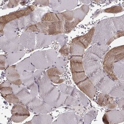 Invitrogen YIPF5 Polyclonal Antibody 100 &mu;L; Unconjugated:Antibodies,