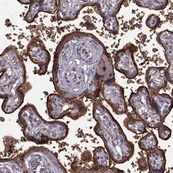 YIPF5 Polyclonal Antibody, Invitrogen 100 &mu;L; Unconjugated:Antibodies,