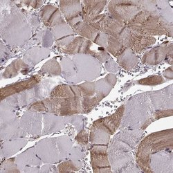 YIPF5 Polyclonal Antibody, Invitrogen 100 &mu;L; Unconjugated:Antibodies,