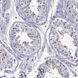 Invitrogen DUSP15 Polyclonal Antibody 100 &mu;L; Unconjugated:Antibodies,