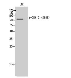 Invitrogen Phospho-GRK2 (Ser685) Polyclonal Antibody 100 &mu;L | Buy Online | Invitrogen&trade; | Fisher Scientific