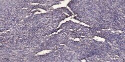 Invitrogen Phospho-SQSTM1 (Ser403) Polyclonal Antibody 100 &mu;L | Buy Online | Invitrogen&trade; | Fisher Scientific