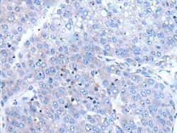 BTG4 Polyclonal Antibody:Antibodies, Polyclonal