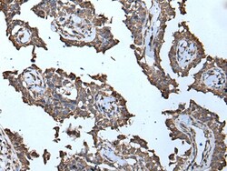 Invitrogen MCM10 Polyclonal Antibody 100 &mu;L; Unconjugated:Antibodies,