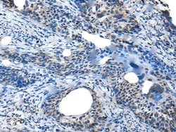 Invitrogen SAA4 Polyclonal Antibody 100 &mu;L; Unconjugated:Antibodies,