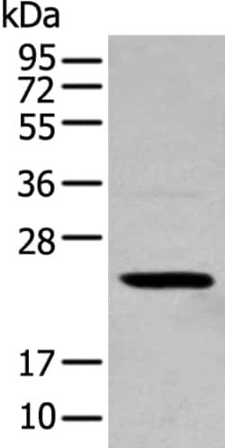 Invitrogen TCEAL4 Polyclonal Antibody 100 &mu;L | Buy Online | Invitrogen&trade; | Fisher Scientific