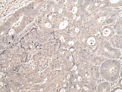 Invitrogen ZNF138 Polyclonal Antibody 100 &mu;L; Unconjugated:Antibodies,