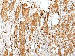 Invitrogen ZMAT2 Polyclonal Antibody 100 &mu;L; Unconjugated:Antibodies,