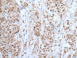 Invitrogen ZNF302 Polyclonal Antibody 100 &mu;L; Unconjugated:Antibodies,