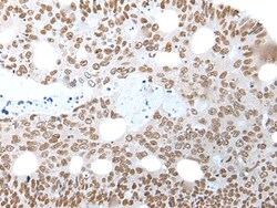 Invitrogen WHSC2 Polyclonal Antibody 100 &mu;L; Unconjugated:Antibodies,