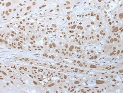 Invitrogen WHSC2 Polyclonal Antibody 100 &mu;L; Unconjugated:Antibodies,
