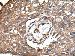 UBE2D3 Polyclonal Antibody, Invitrogen 100 &mu;L; Unconjugated:Antibodies,