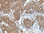 Thumbnail_UBE2D3 Polyclonal Antibody, Invitrogen 100 &mu;L; Unconjugated:Antibodies,