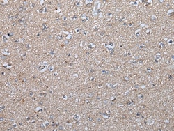 Invitrogen FGF5 Polyclonal Antibody 100 &mu;L; Unconjugated:Antibodies,