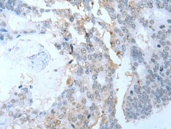 Invitrogen SYCP2 Polyclonal Antibody 100 &mu;L | Buy Online | Invitrogen&trade; | Fisher Scientific