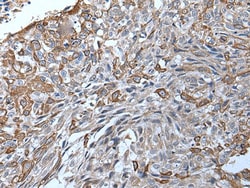 Invitrogen TRPC5 Polyclonal Antibody 100 &mu;L | Buy Online | Invitrogen&trade; | Fisher Scientific