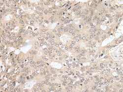Invitrogen HOXA2 Polyclonal Antibody 100 &mu;L; Unconjugated:Antibodies,