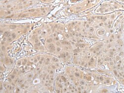 Invitrogen HOXD3 Polyclonal Antibody 100 &mu;L; Unconjugated:Antibodies,