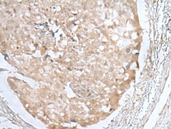 Invitrogen HOXD3 Polyclonal Antibody 100 &mu;L; Unconjugated:Antibodies,