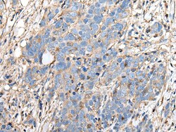 Invitrogen HRASLS3 Polyclonal Antibody 100 &mu;L; Unconjugated:Antibodies,