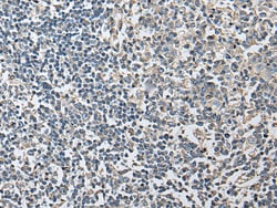 Invitrogen HRASLS3 Polyclonal Antibody 100 &mu;L; Unconjugated:Antibodies,