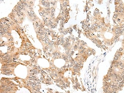 Invitrogen CASC5 Polyclonal Antibody 100 &mu;L; Unconjugated:Antibodies,