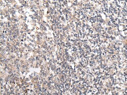 Invitrogen MT-ND5 Polyclonal Antibody 100 &mu;L; Unconjugated:Antibodies,