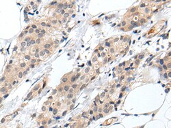 PROK1 Polyclonal Antibody:Antibodies, Polyclonal