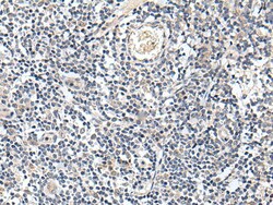 PROK1 Polyclonal Antibody:Antibodies, Polyclonal