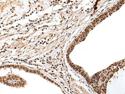 PTOV1 Polyclonal Antibody:Antibodies, Polyclonal