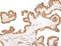 PTOV1 Polyclonal Antibody:Antibodies, Polyclonal