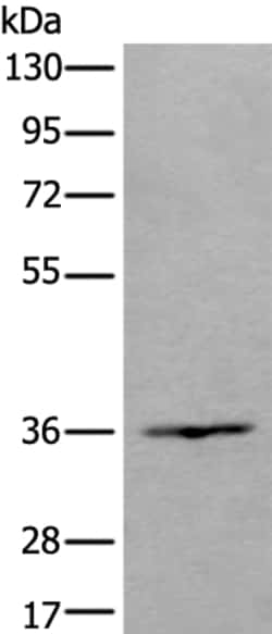 Invitrogen HOXD10 Polyclonal Antibody 100 &mu;L; Unconjugated:Antibodies,